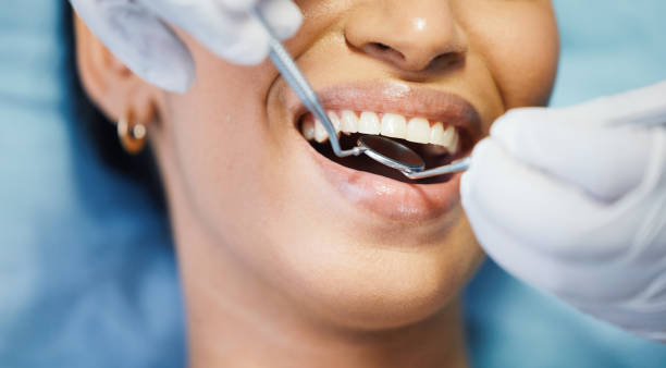 Best Emergency Dental Extractions in Coalville, UT